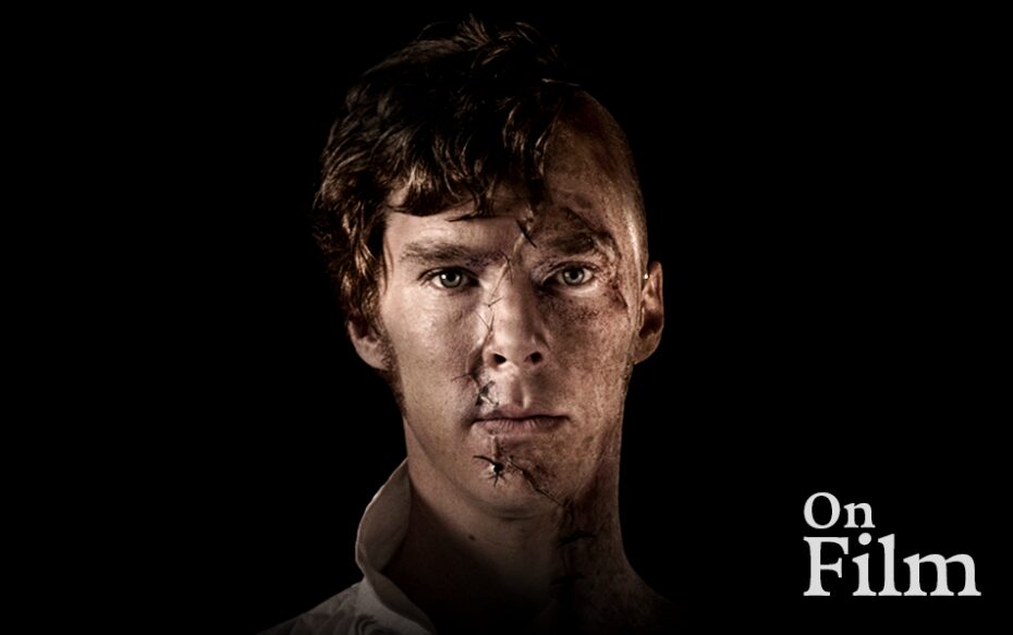 Benedict Cumberbatch in Frankenstein. His face is stitched up.