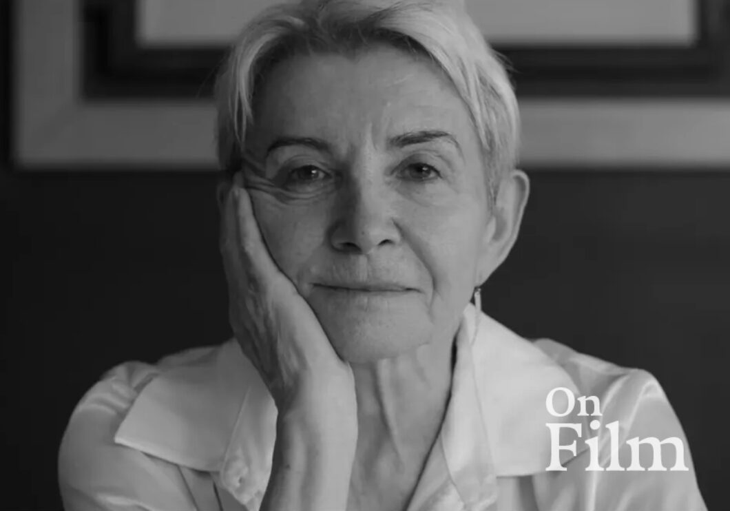 A woman rest her face in her hand.